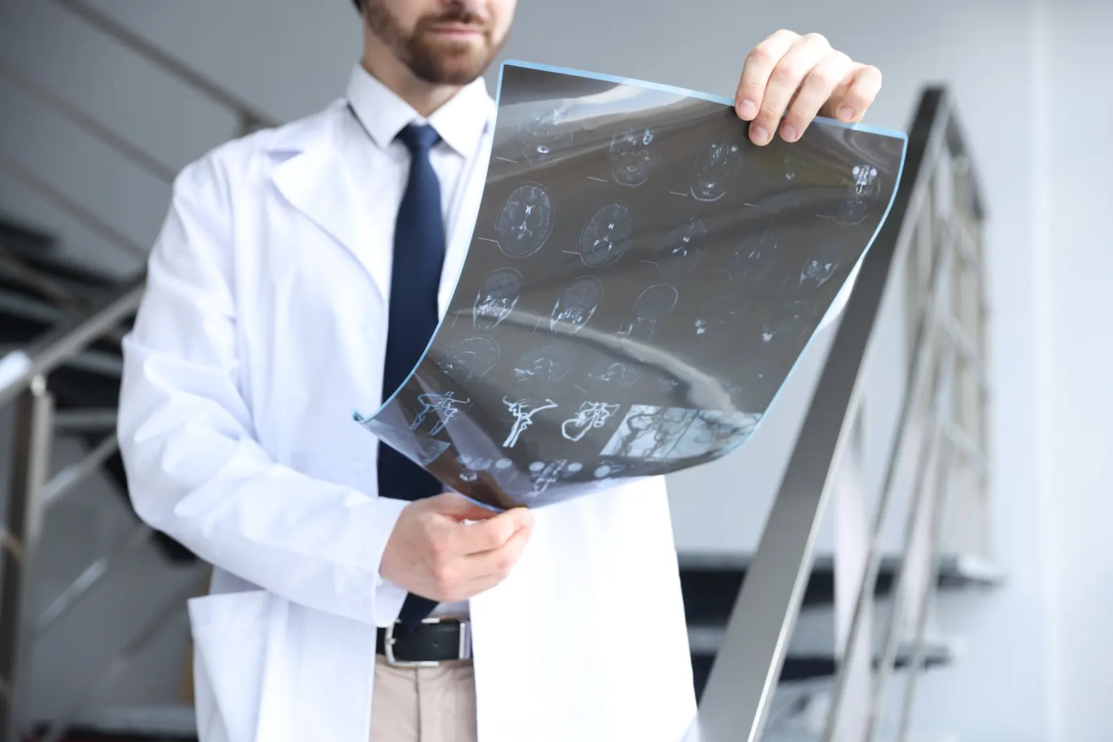 Doctor reviewing a chest X-ray