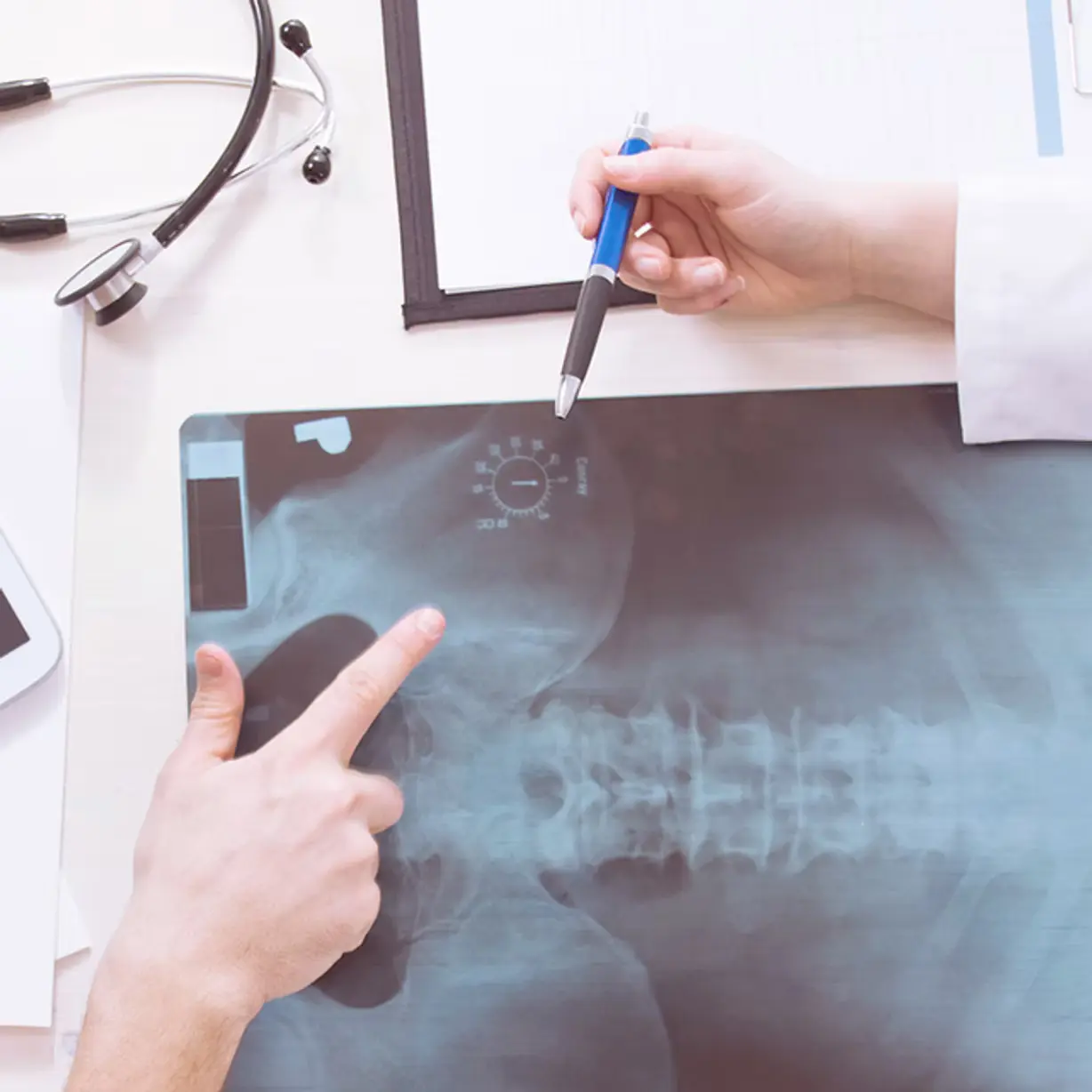 Doctor reviewing a chest X-ray
